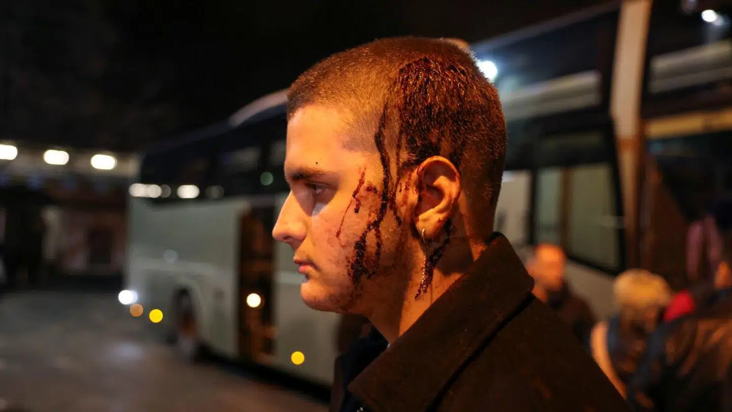 En såret passager efter ulykken, som har kostet adskillige menneskeliv.