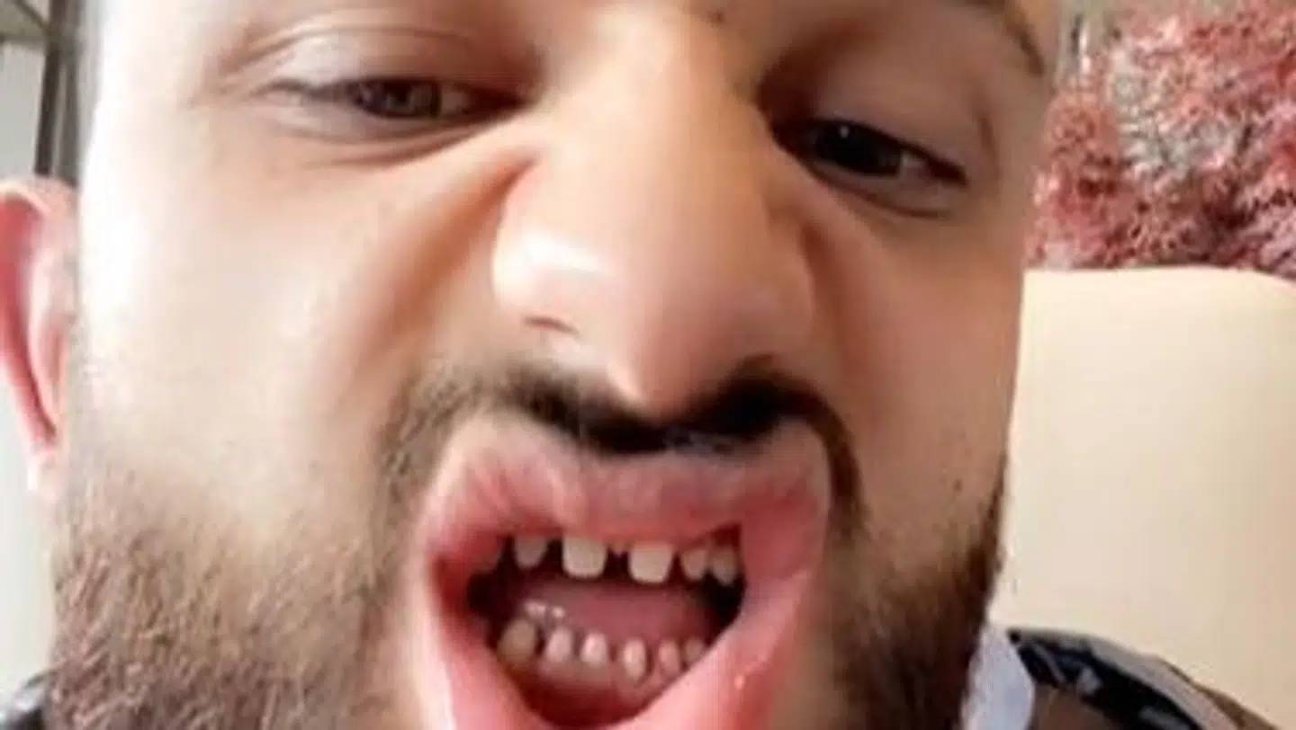 Mahmouds tænder er gået viralt på de sociale medier. Foto: Instagram