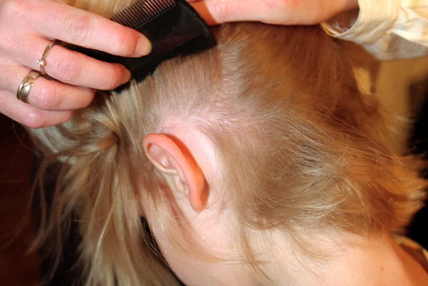 Tirsdag 31. januar er Store Lusedag, som skal sætte opmærksomhed på at forældre skal tjekke deres børn for lus. (Arkivfoto). Bjørn Khler/Ritzau Scanpix