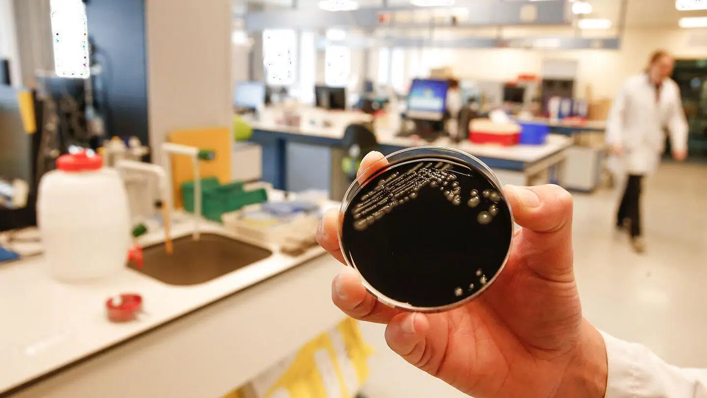 Der er fundet legionella-bakterier i det varme vand på et plejehjem i Højby. Her ses legionella-bakterier på et belgisk hospital (arkivfoto).