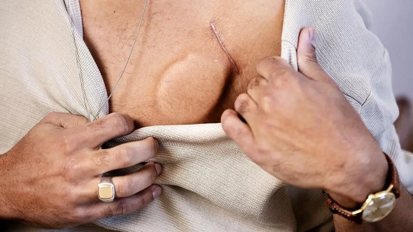 Den tidligere professionelle fodboldspiller Jonathan Richter fik i oktober hjertestop. Han har fået en ICD-enhed opereret ind. Den giver en sikkerhed og en tryghed, hvilket også betyder, han ikke umiddelbart er bange for, at det sker igen.