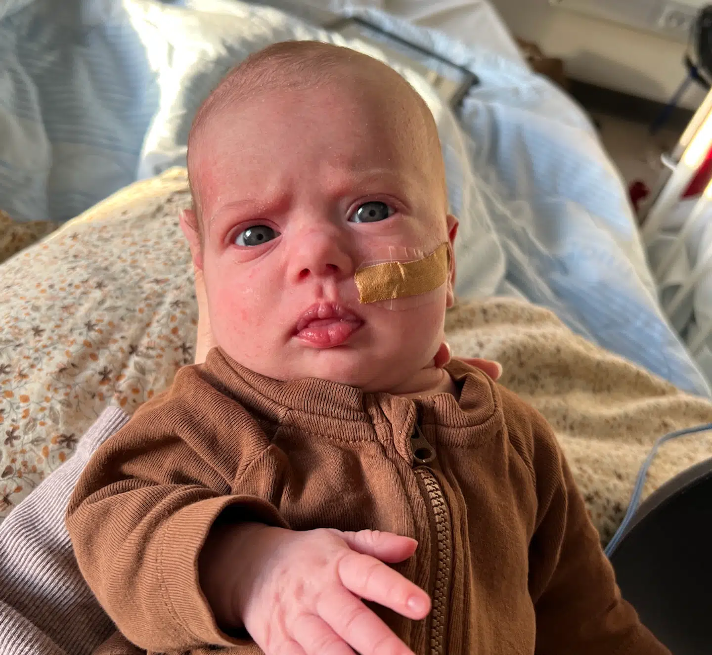 Mille Baltersen på cirka fem uger har netop været indlagt med RS-virus, og hun er bestemt ikke den eneste.