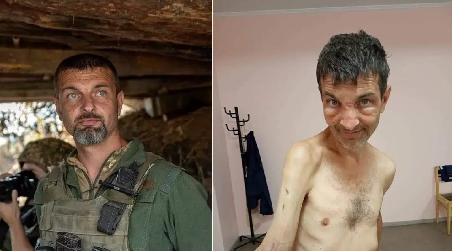 Her ses et før- og efterbillede af Mykhailo Dianov, der var blandt de 215 ukrainske soldater, som onsdag blev frigivet i en stor fangeudveksling.