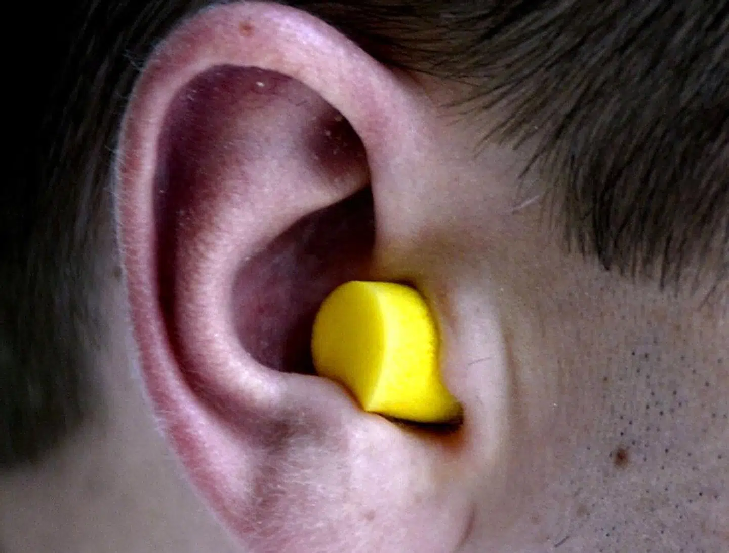 Pas på ørerne, når du går til koncert. Fem minutter kan være nok til at lave varige skader på ørerne, hvis musikken spiller for højt.