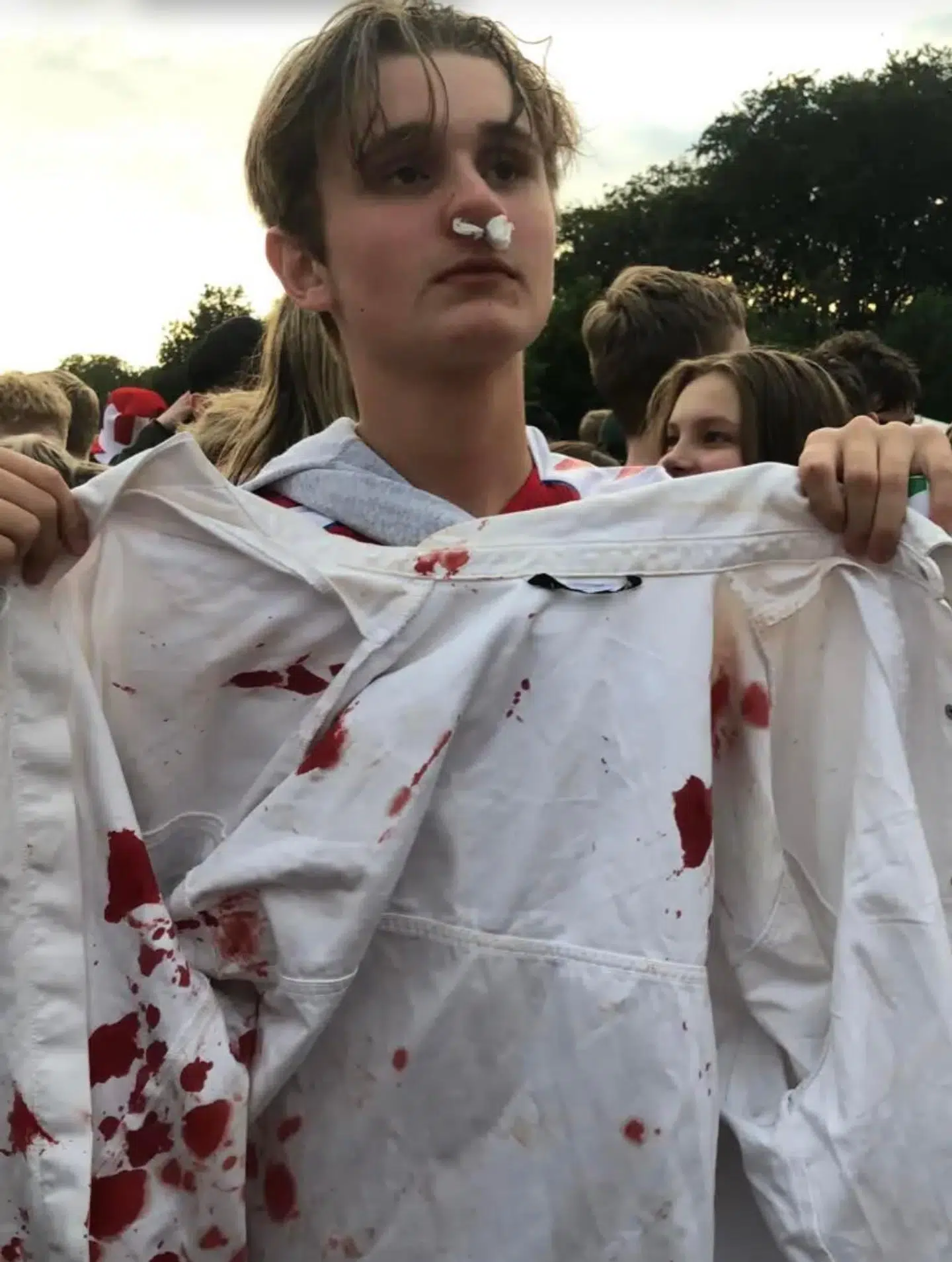 Lasse Lillegaard efter at være blevet ramt af en fyldt øldåse