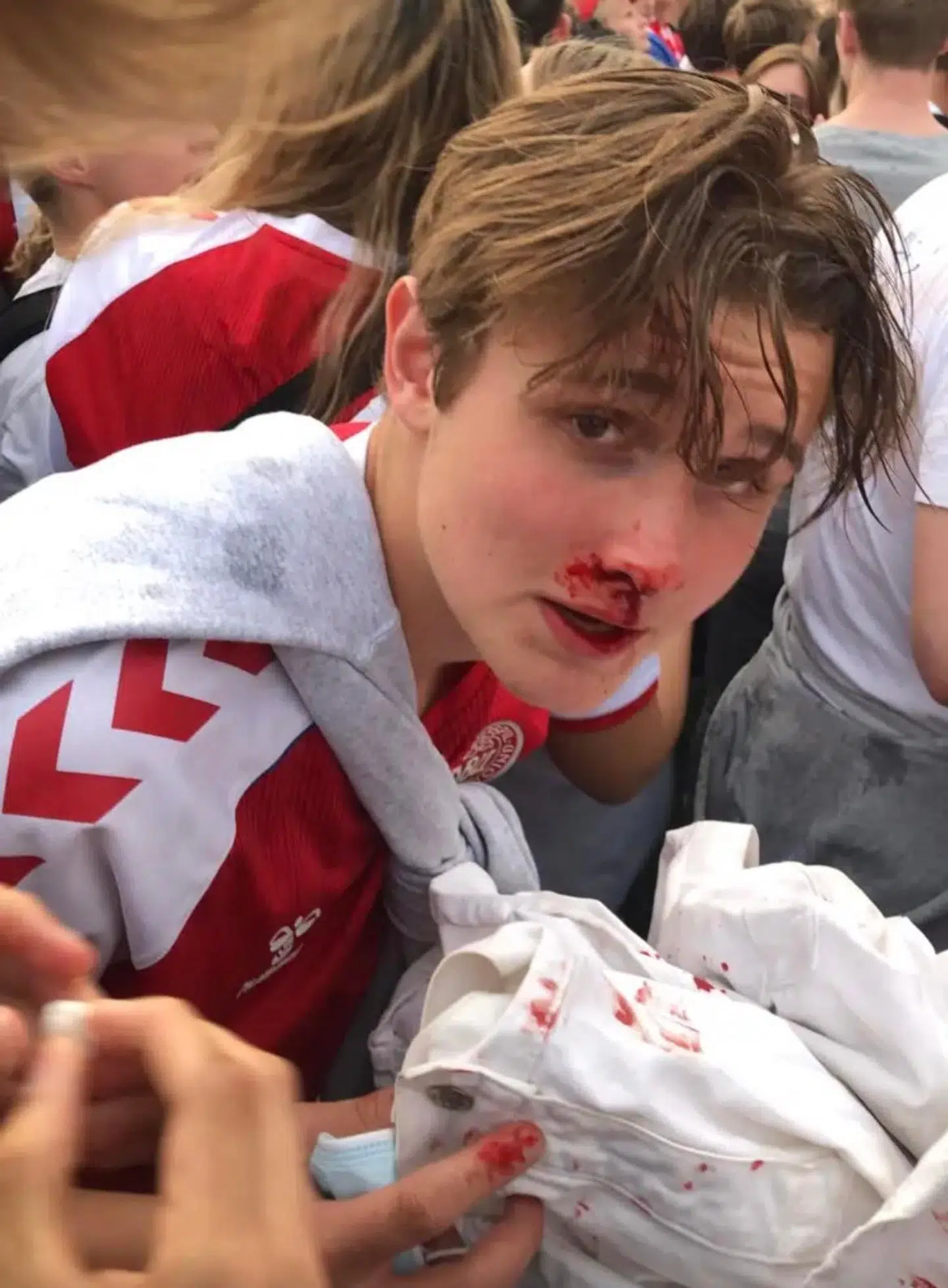 Lasse Lillegaard efter at være blevet ramt af en fyldt øldåse