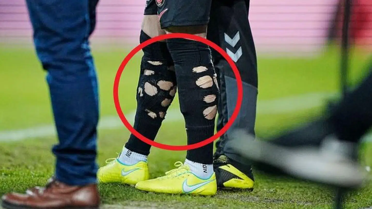 Hullerne i strømper er helt bevidste.