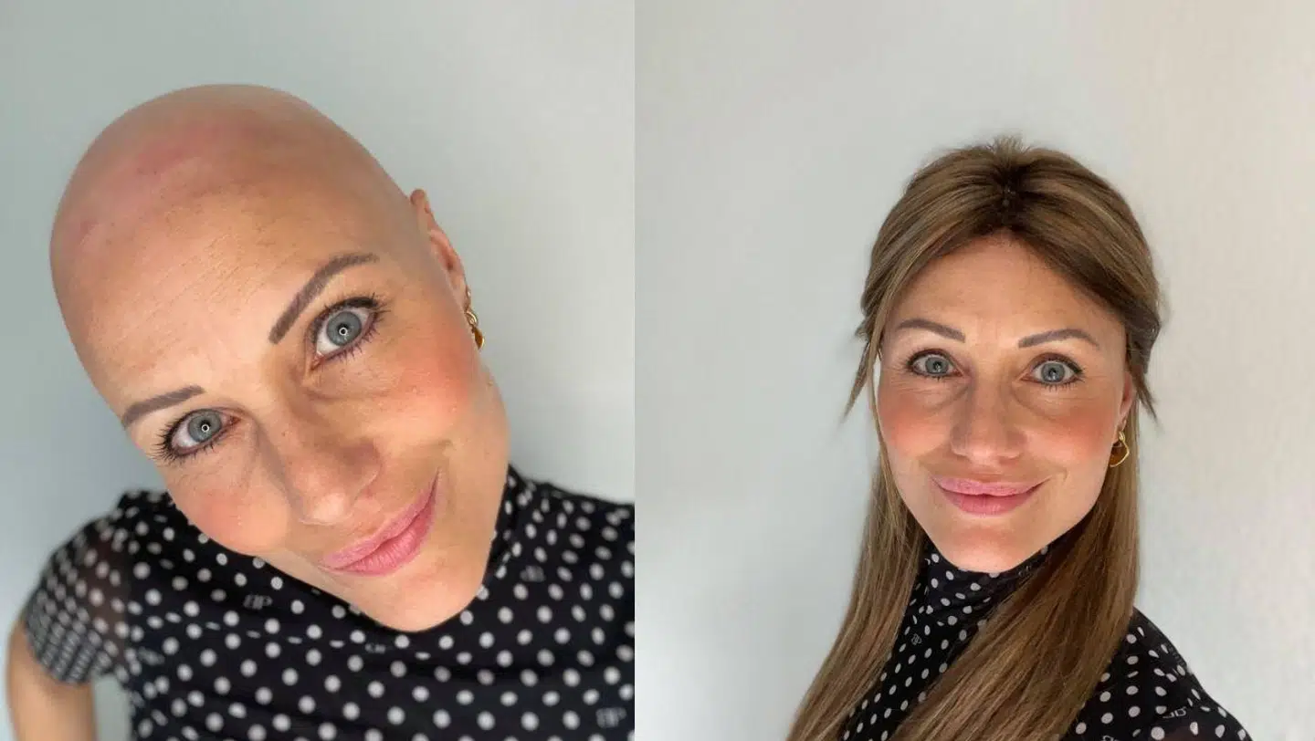 For det meste har Herit Helgadóttir paryk på, når hun er ude eller på arbejde. Men når hun træner eller er hjemme, foretrækker hun at smide den.