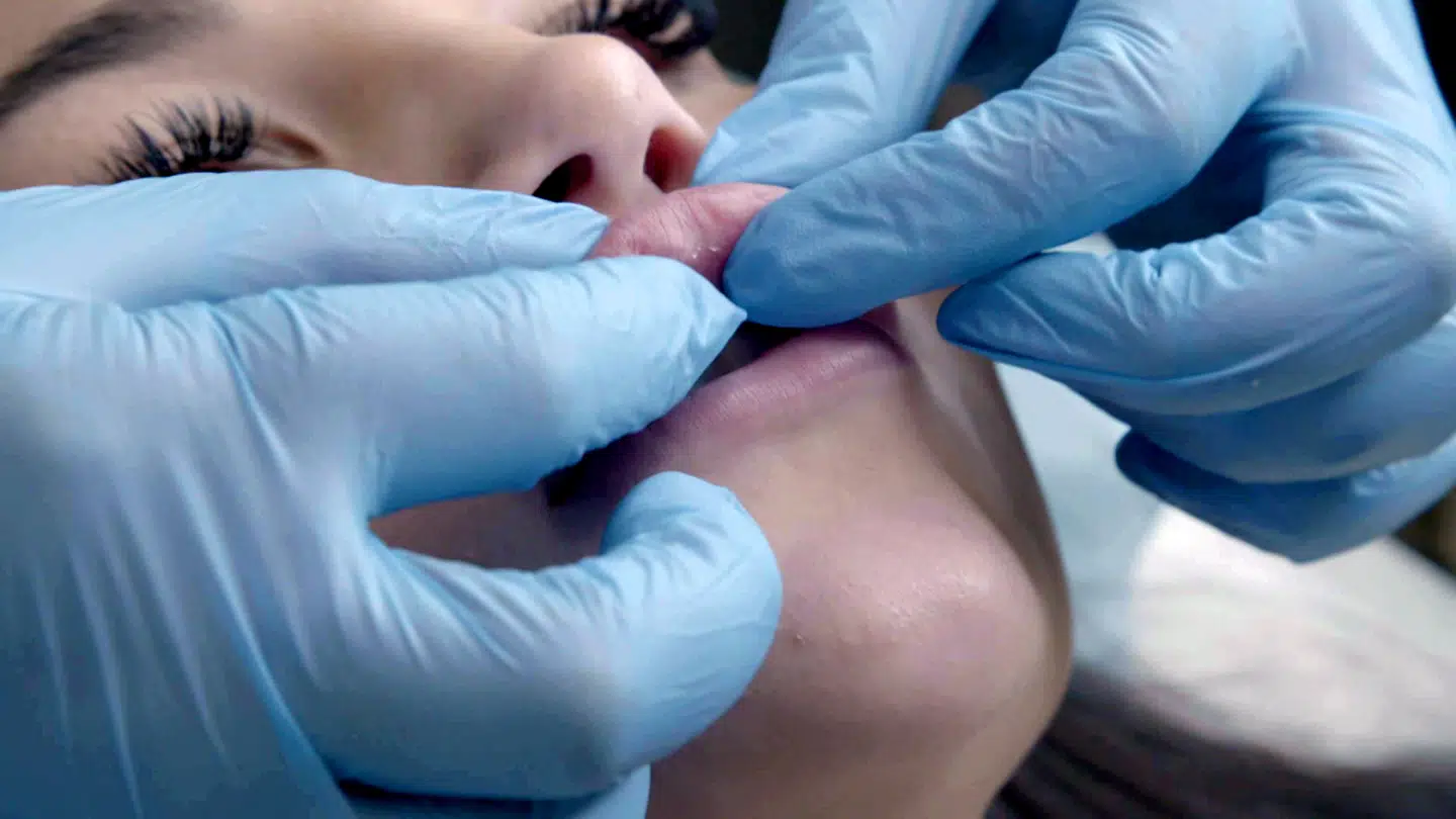 Den eneste person, der står frem med navn i dokumentaren, hvis læber her bliver undersøgt, var ikke fra skønhedsklinikken i Odense. Foto: Jens Kolding, DR