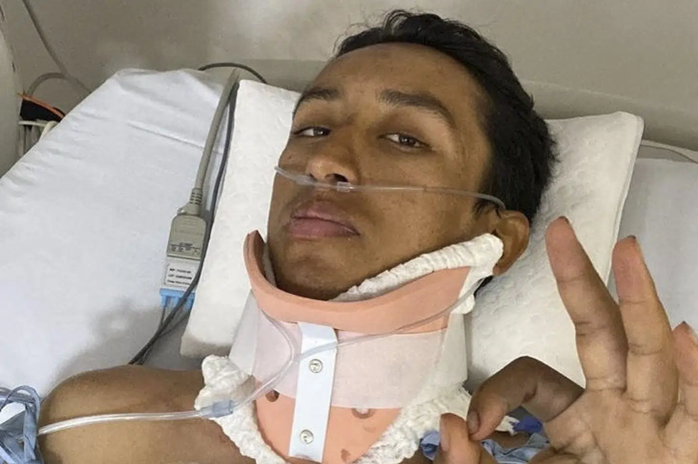 Egan Bernal var efter sit styrt i overhængende fare for at blive lam i begge ben. Handout/Ritzau Scanpix