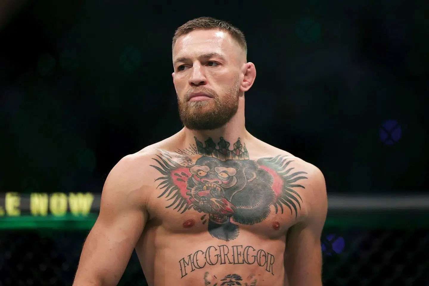Sådan så Conor McGregor ud ved sin kamp i juli.
