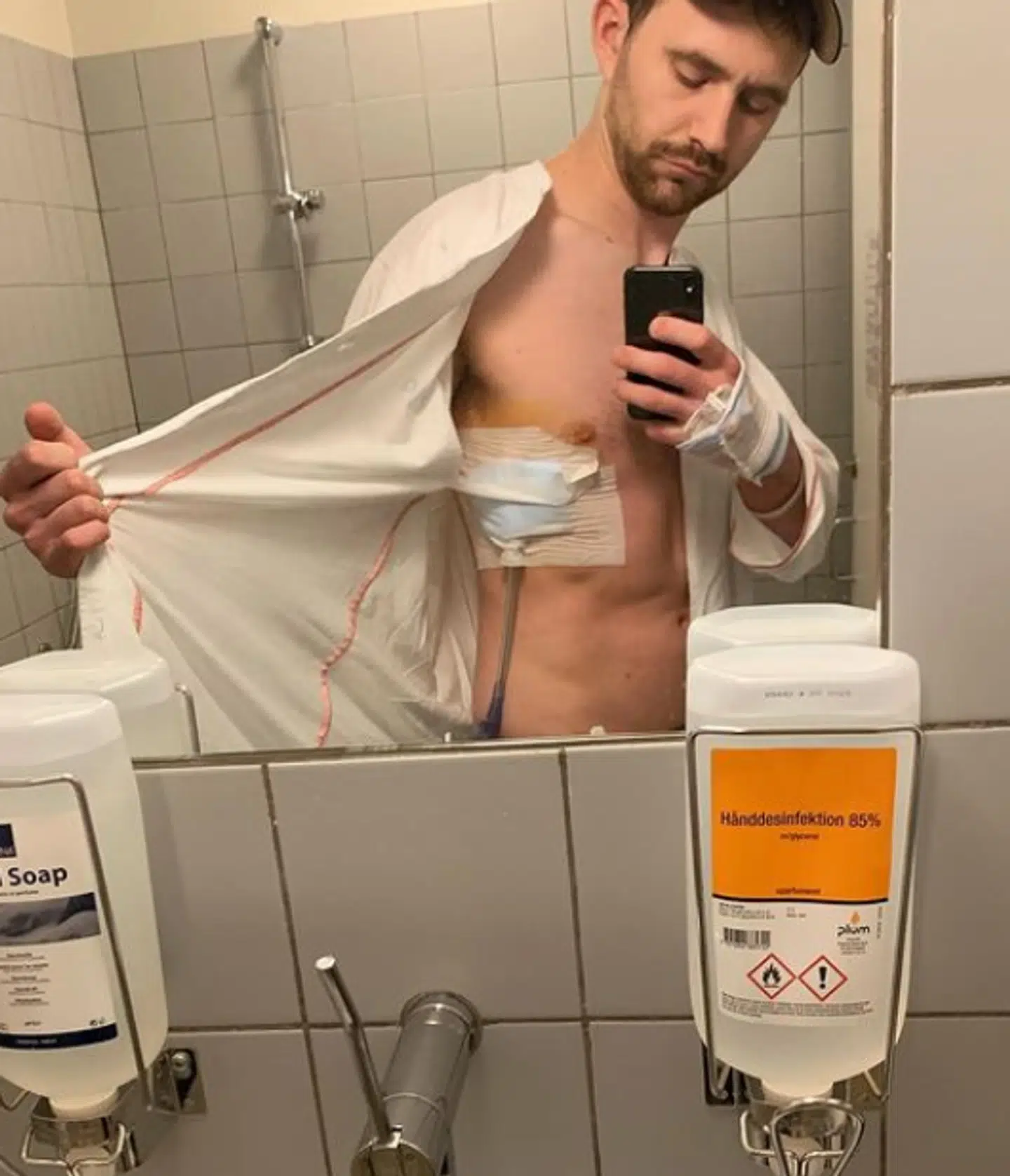 William efter operation, hvor han fik lagt et dræn i kroppen.