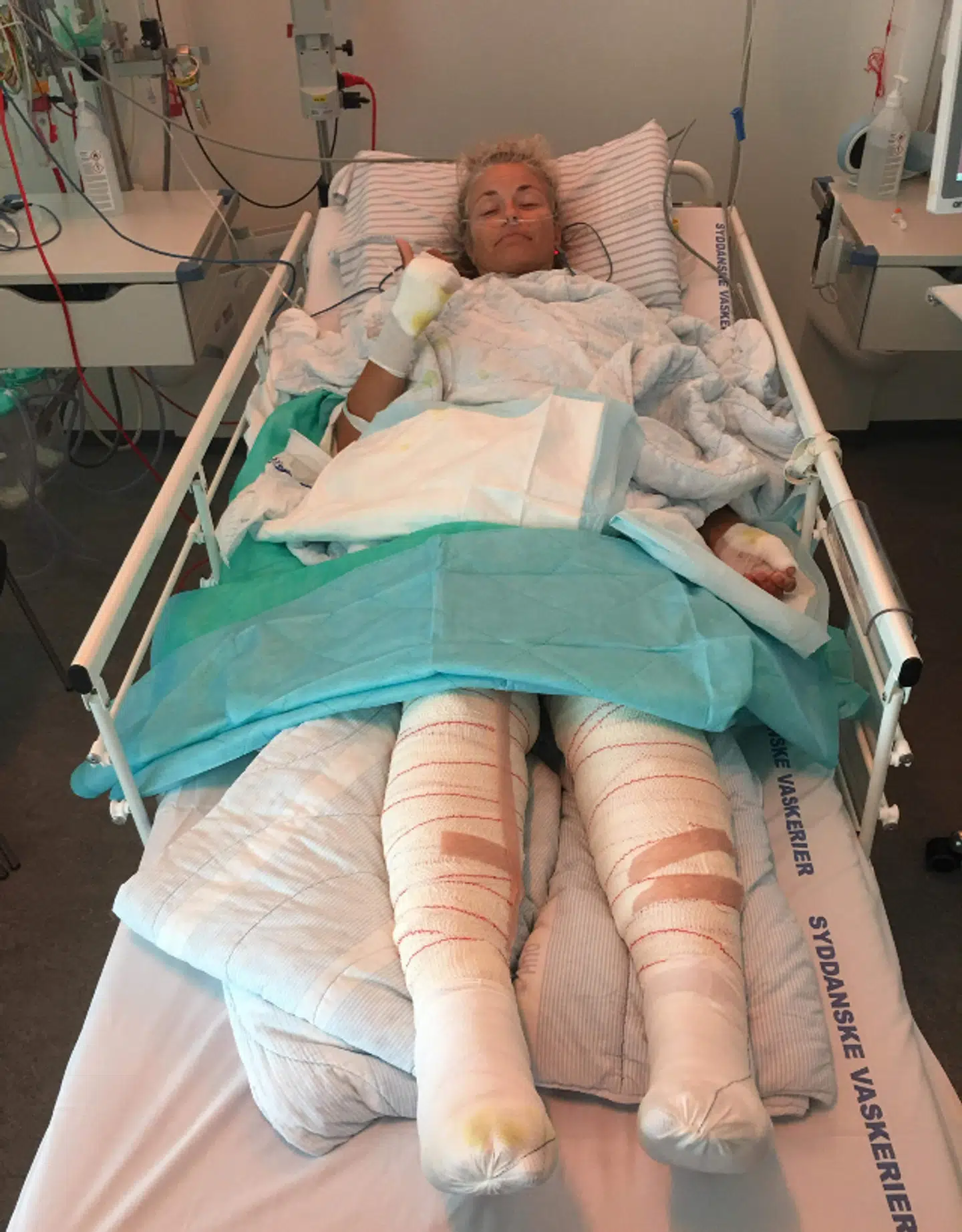 Tine Bay var indlagt i 50 dage og har i alt været i narkose 15 gange.