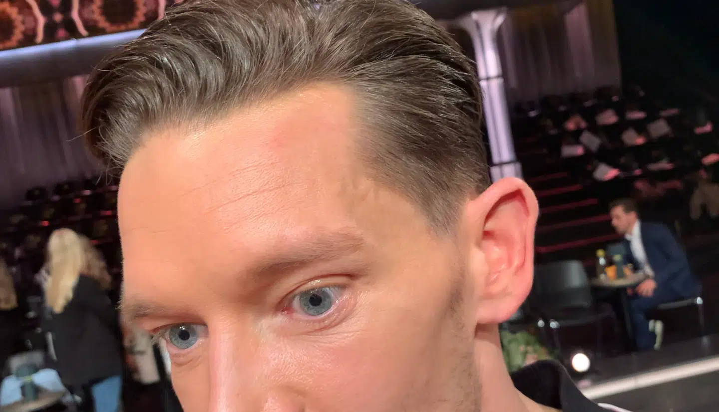 Bag makeuppen kan man ane såret.