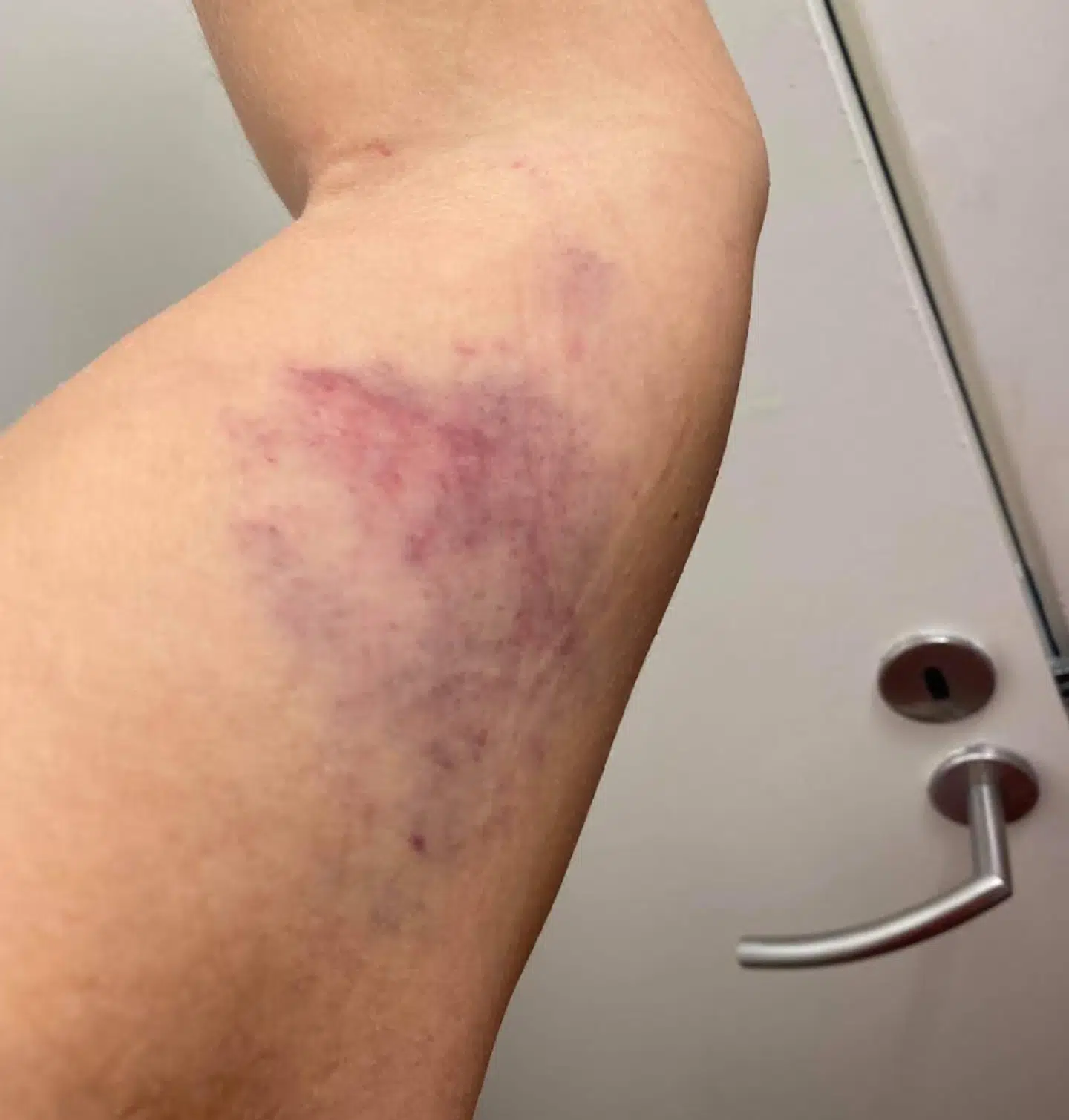 En veninde forsøgte at beskytte Sólbjørg, men endte selv med at få blå mærker.