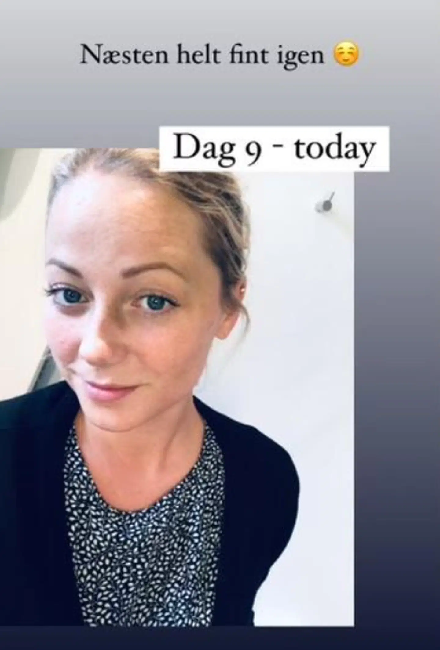 Ni dage efter hændelsen.