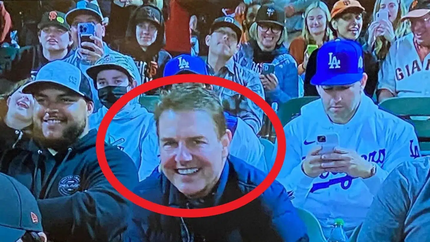 Tom Cruise blev spottet til en baseballkamp, og her vakte hans hævede ansigt opsigt.