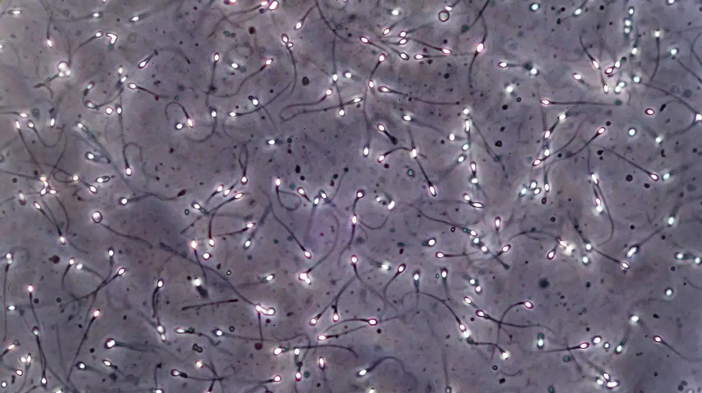 Levende sædceller set gennem et mikroskop.