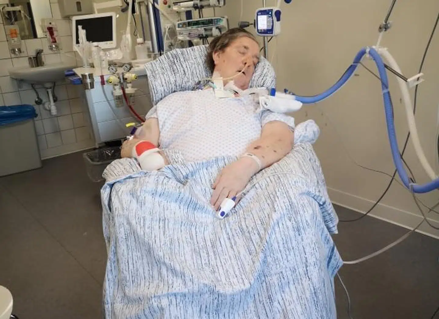 Bent er her i koma, men her er han sat op, så lungerne kan ventilere