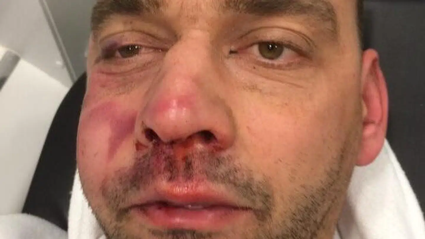 Sådan så Allan Jensen ud efter mødet med tyren.