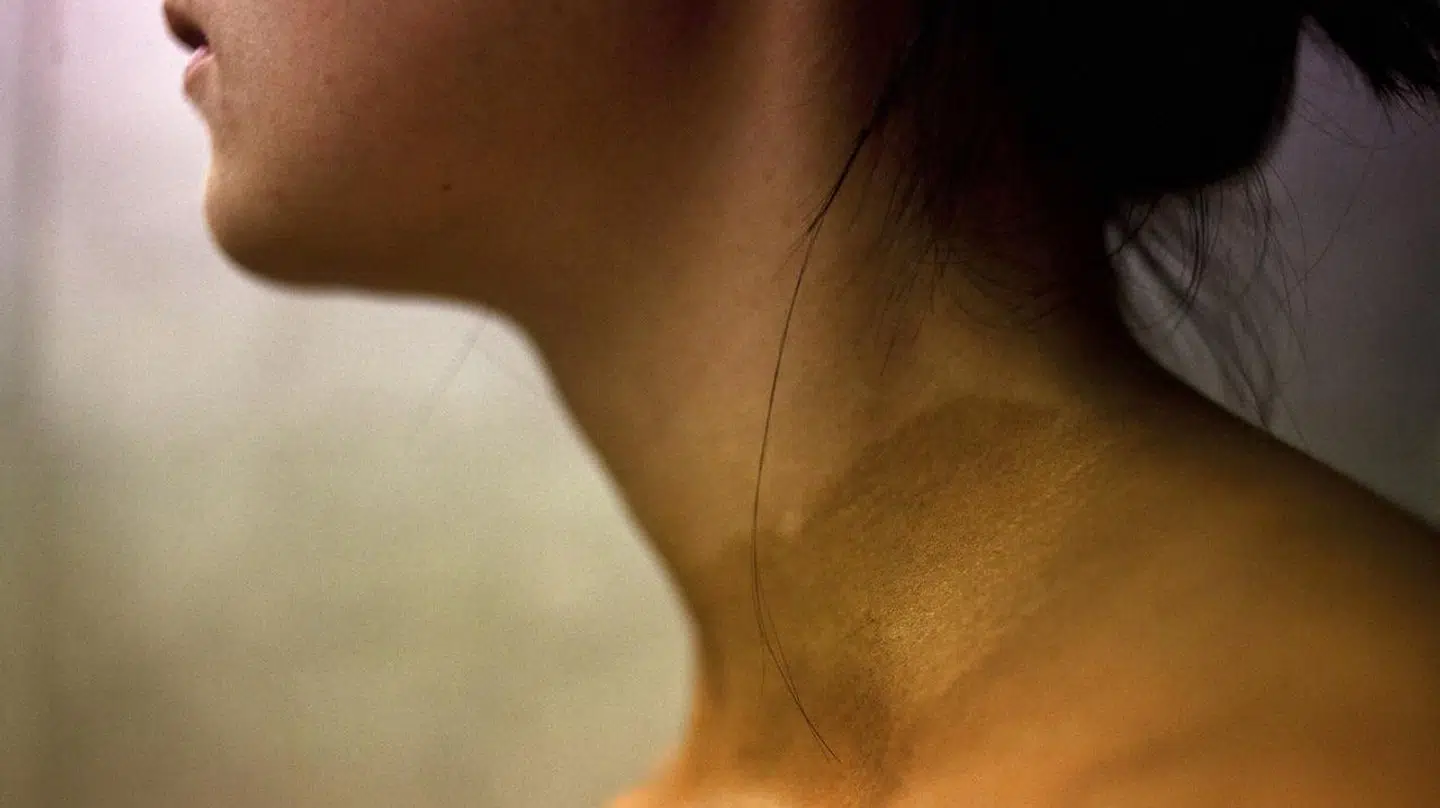 Spraytan kan være et alternativ til solarium, foreslår Kræftens Bekæmpelse.