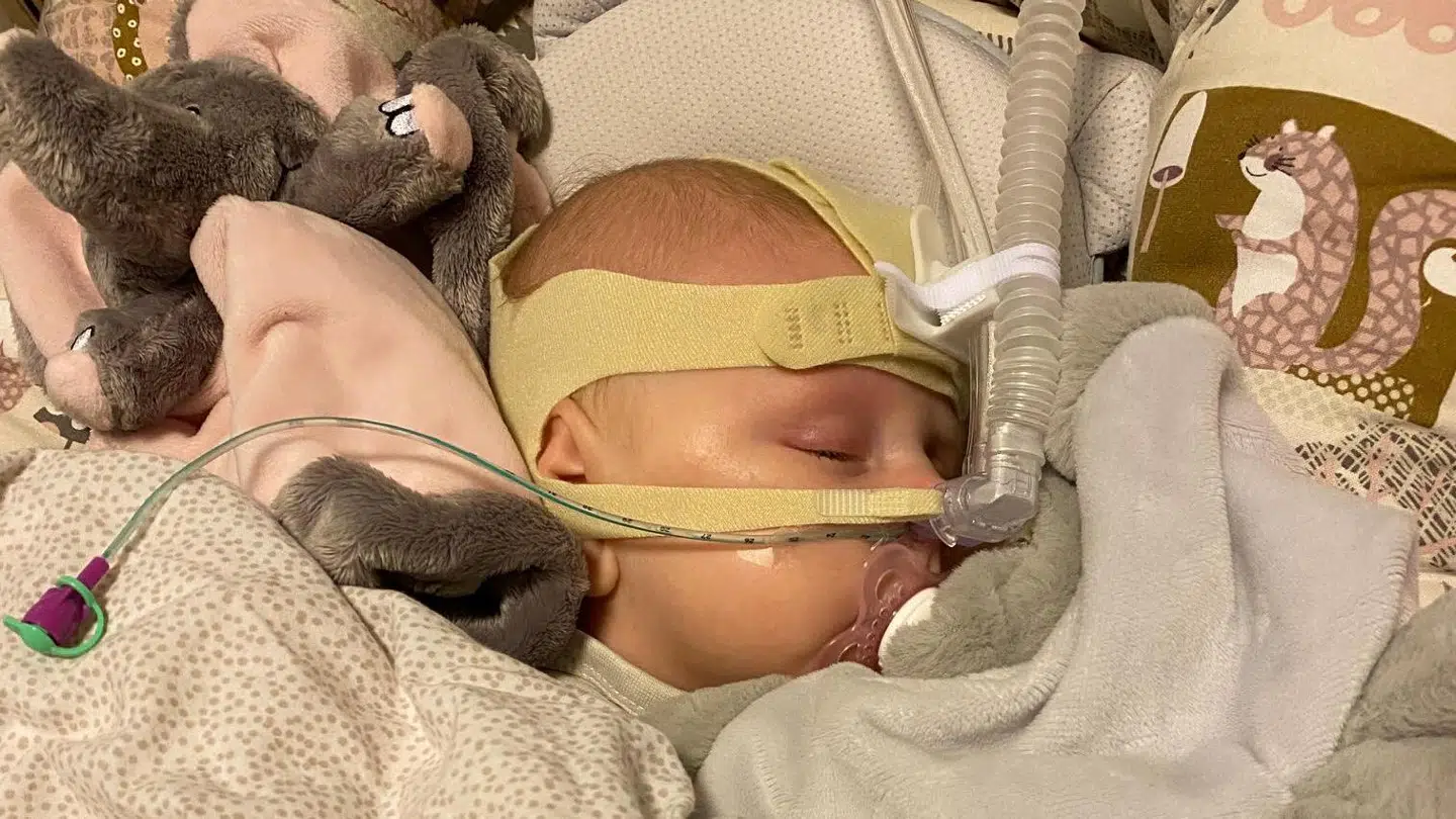 Sophia måtte både have sonde og CPAP-maske under sin indlæggelse (Privatfoto)