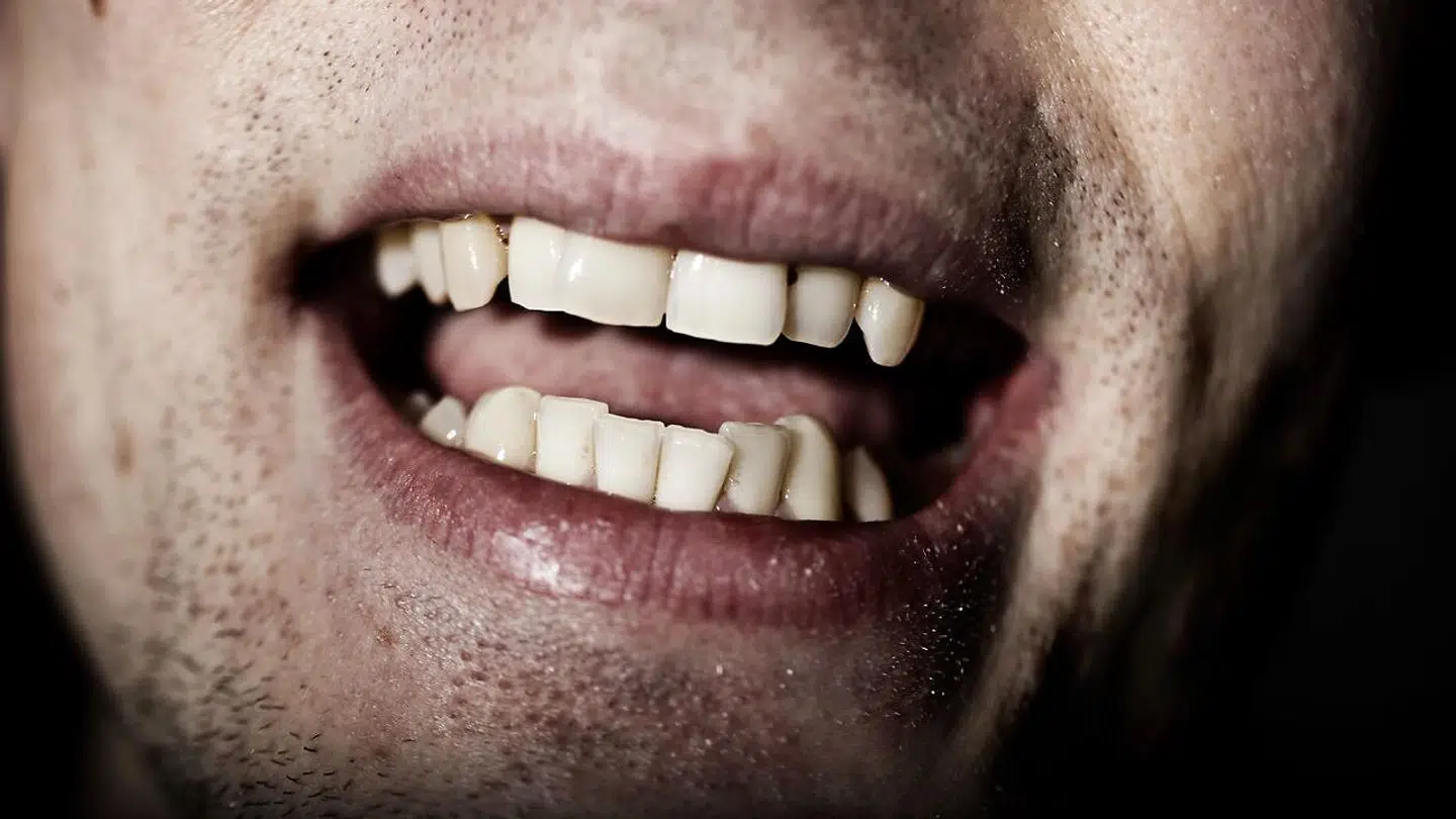 Fem ud af 25 kan føre til alvorlige skader