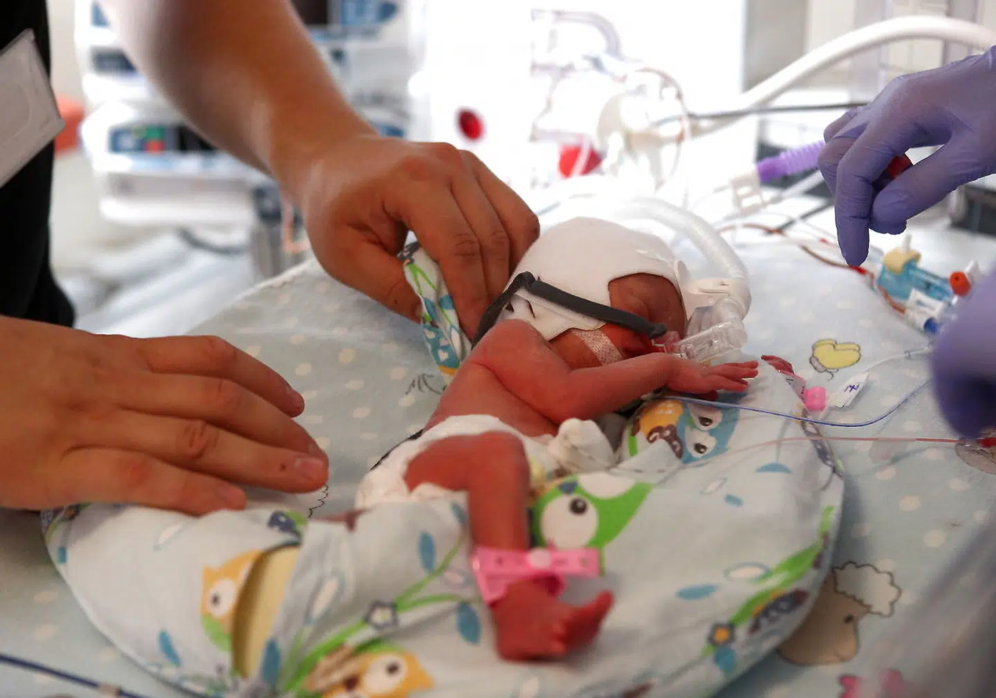 De to piger blev forbyttet, mens de var lagt i inkubatorer. Dette billede viser ikke pigen. ARKIVFOTO.