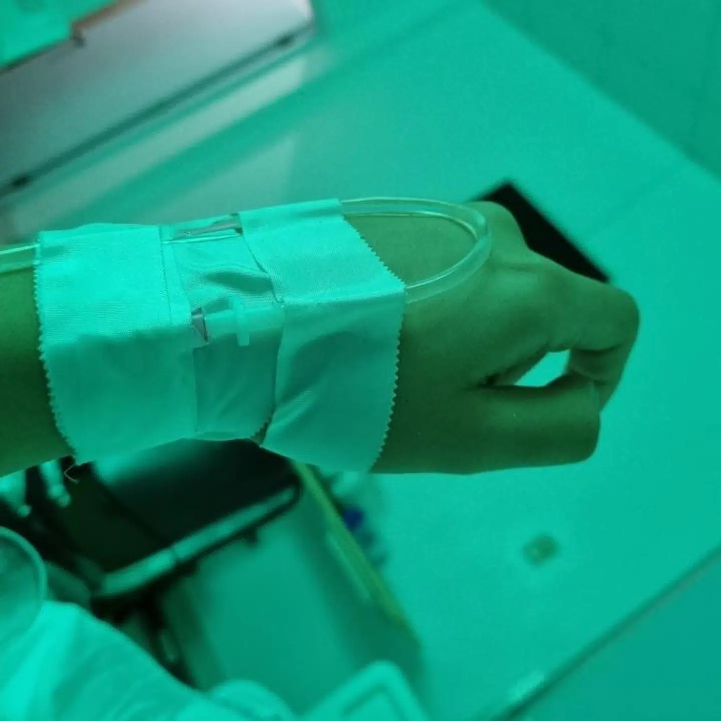 Asma måtte igennem to blodtransfusioner under sit ophold på det dominikanske hospital.