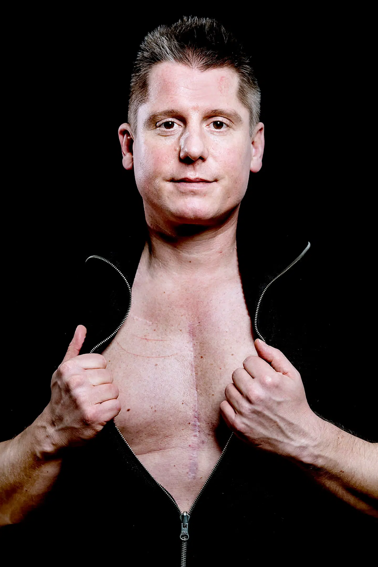 I 2015 vågnede skuespiller Robert Hansen op på Rigshospitalets intensivafdeling med et stort operationsar ned ad brystet. Fra den ene dag til den anden var han blevet hjertepatient.