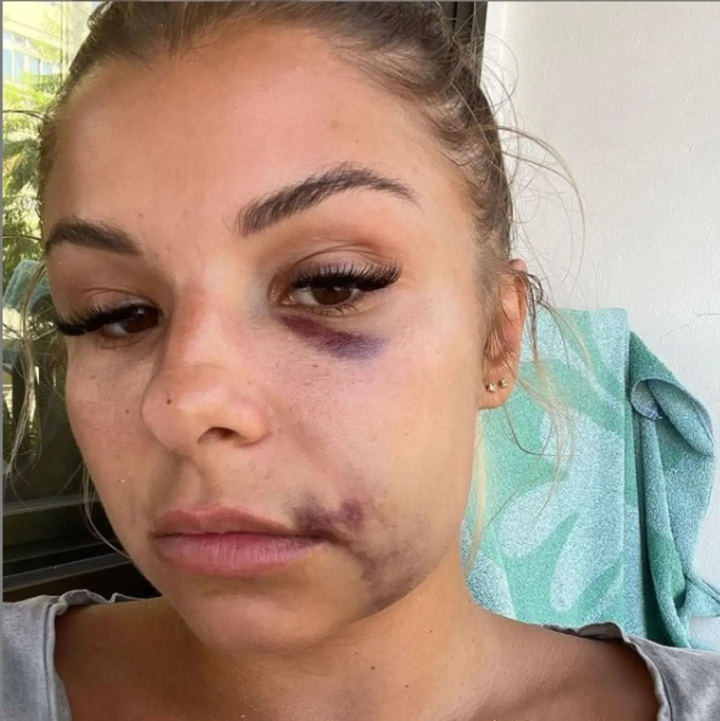 Det er disse skader, som Nynne Larsen påstår, Robert Hansen står bag. Foto: Privat