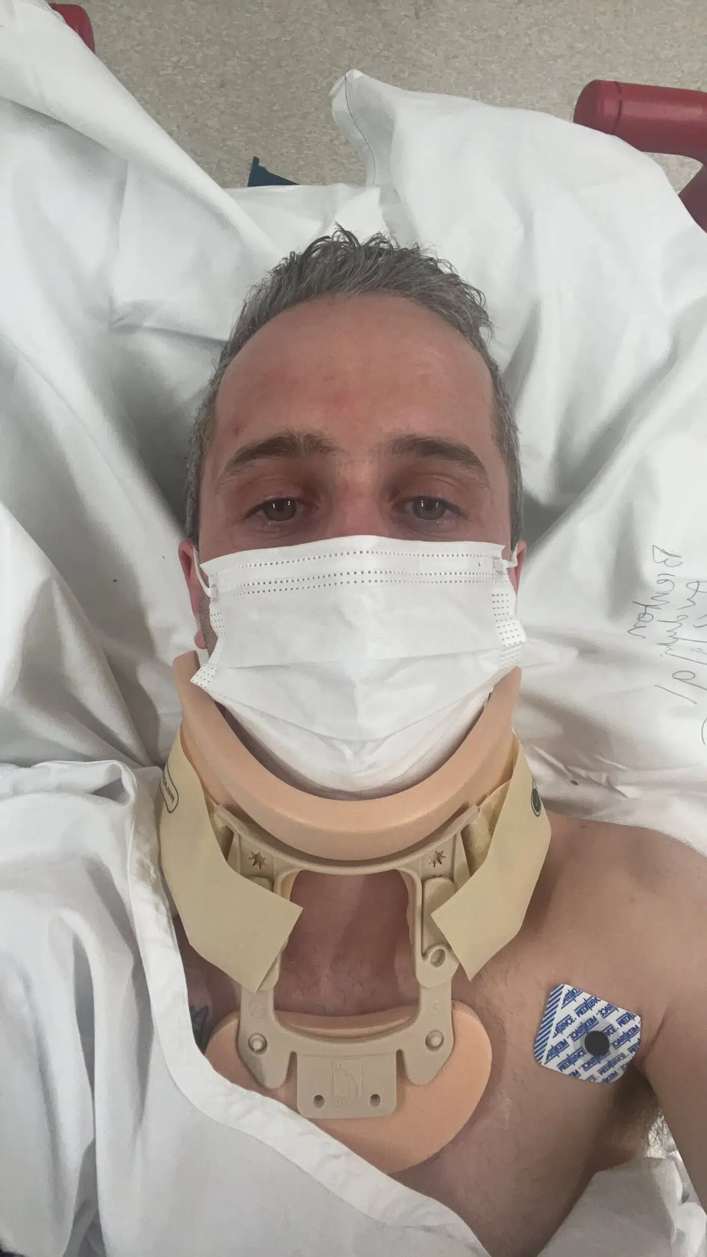 Brenton Avdulla er indlagt efter styrtet.