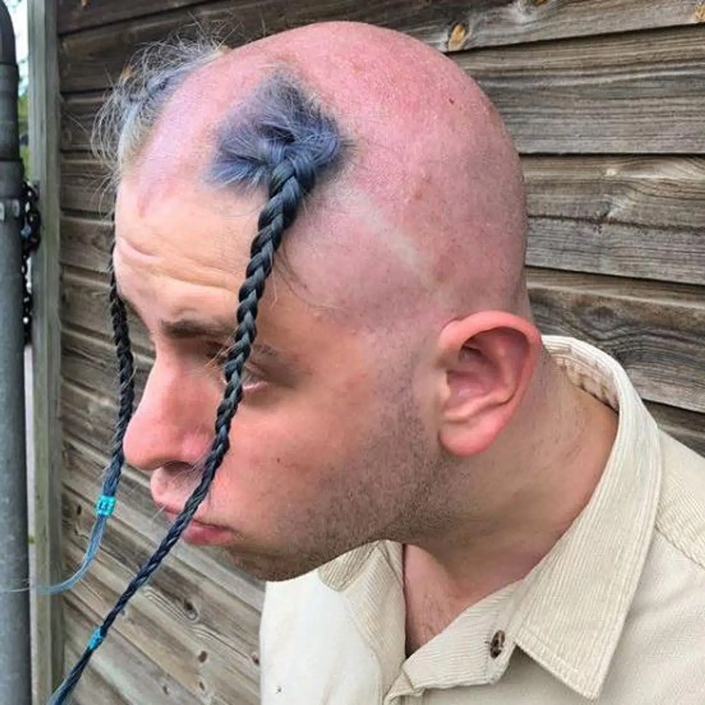 Albert Dyrlunds klippede sit velkendte lange hår af og skiftede frisuren ud med denne for at chokere sig til et nyt publikum og skabe opmærksomhed omkring sin sang 'Vafler'.