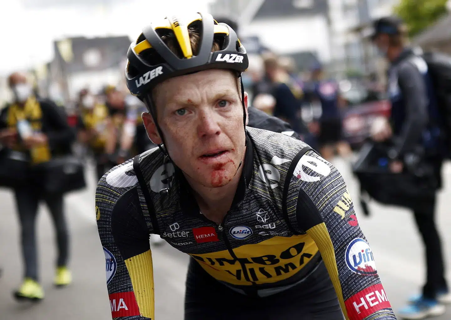 Steven Kruijswijk var en af de, der kom slemt til skade under dagens etape.
