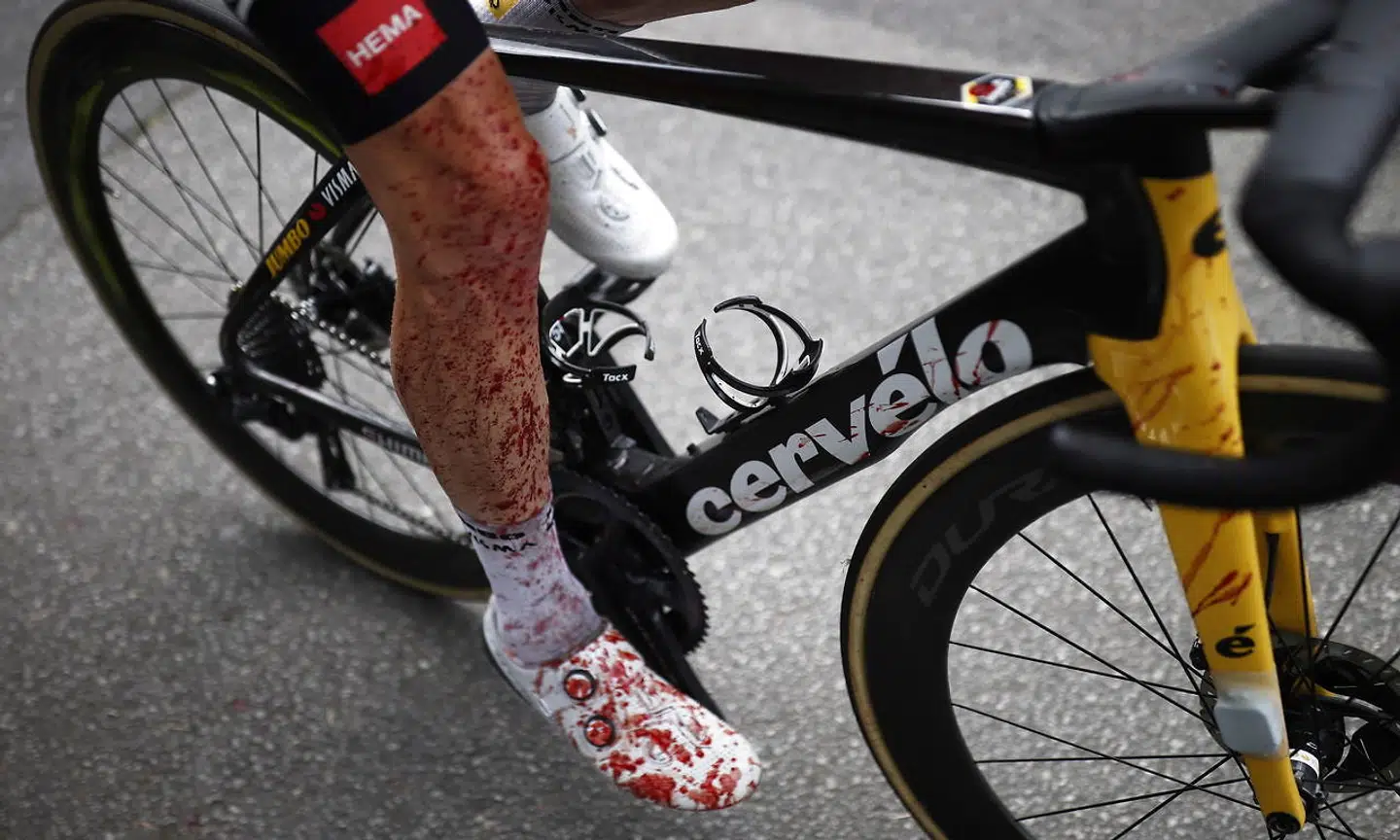 Steven Kruijswijks ben, da han kom i mål efter etapen.