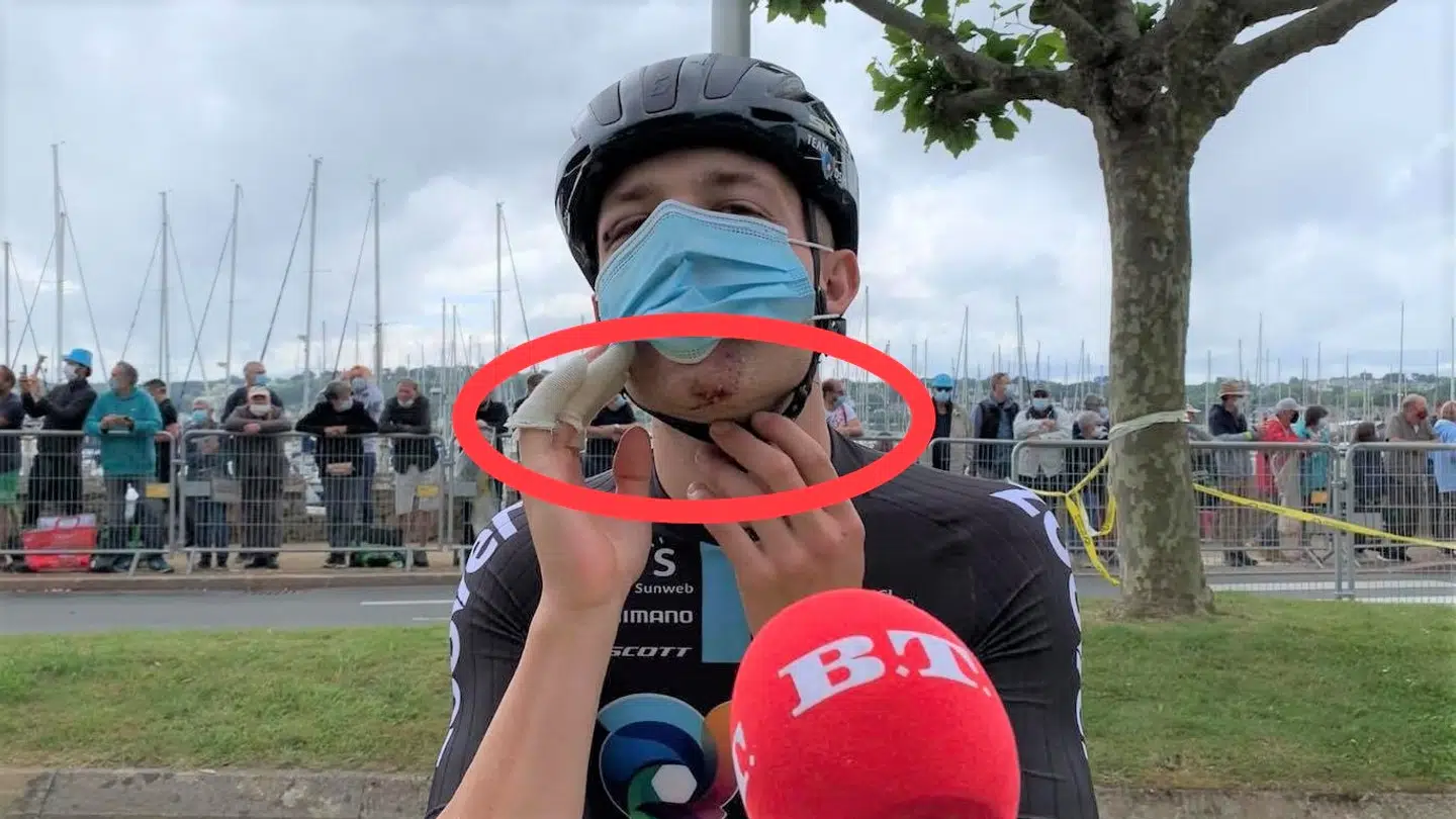 Casper Pedersen kom slemt til skade på Tourens første etape.