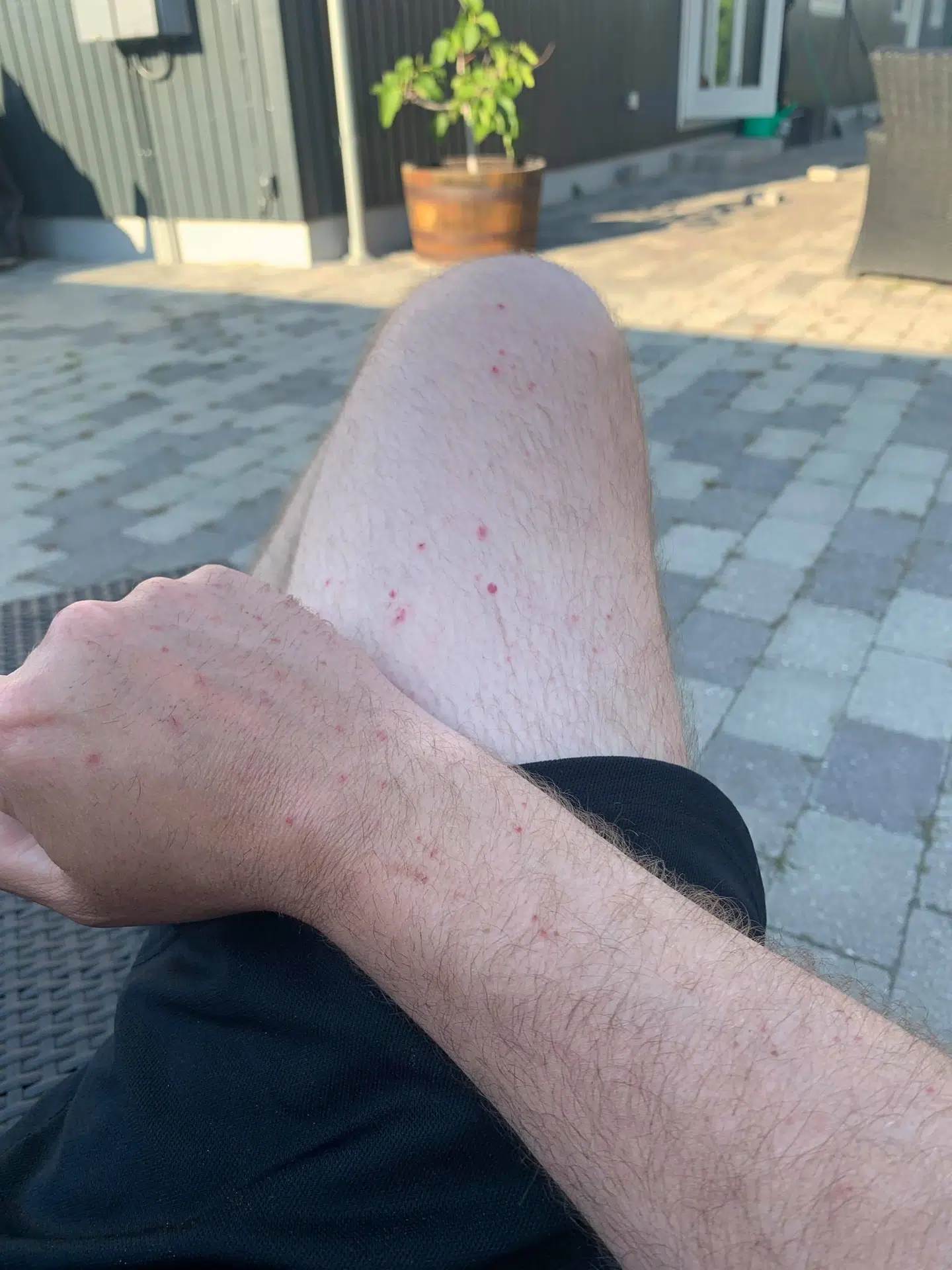 Henrik Svane kunne pille glasskår ud i løbet af torsdagen.