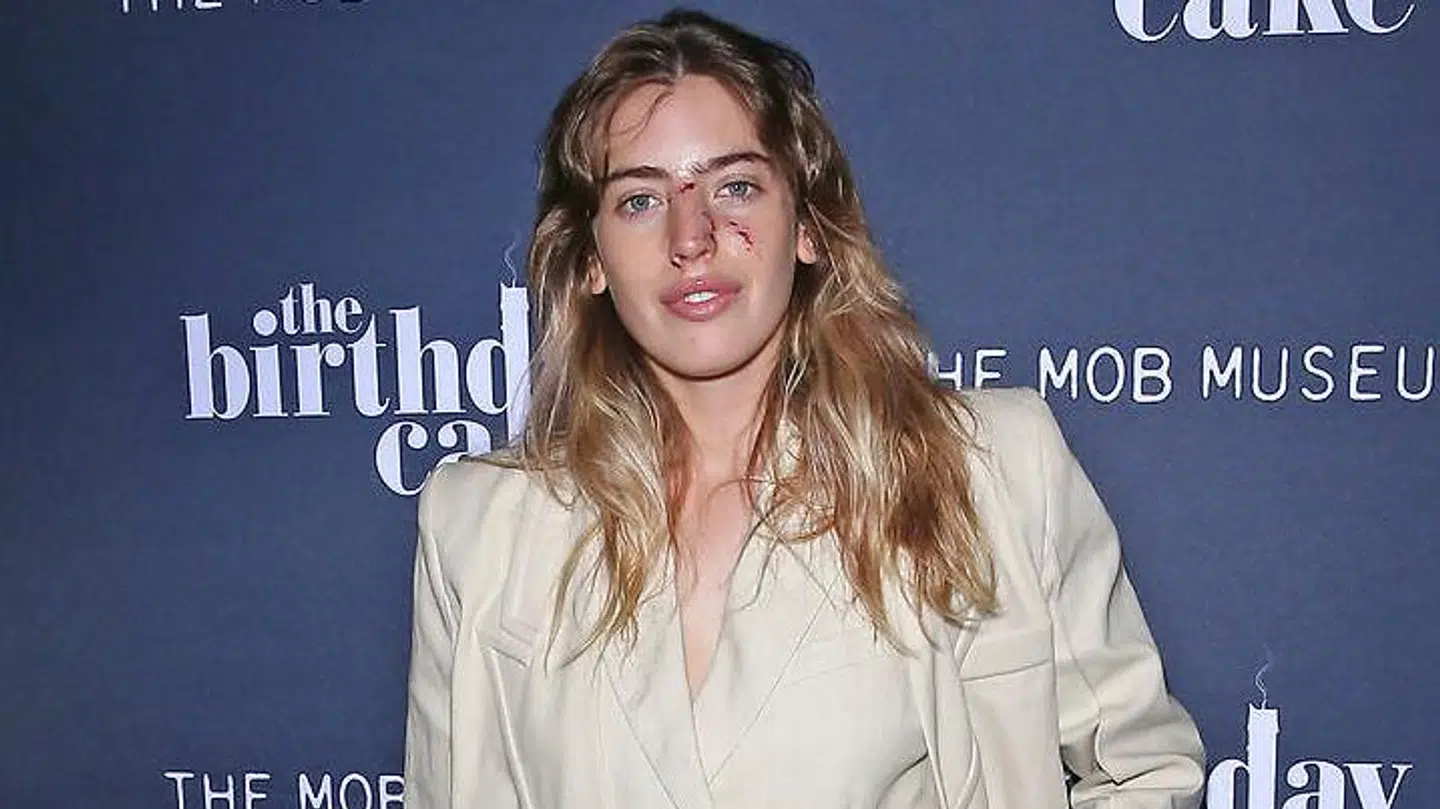 Clara McGregor havde rifter rundt omkring i ansigtet, da hun forleden dukkede op på den røde løber.