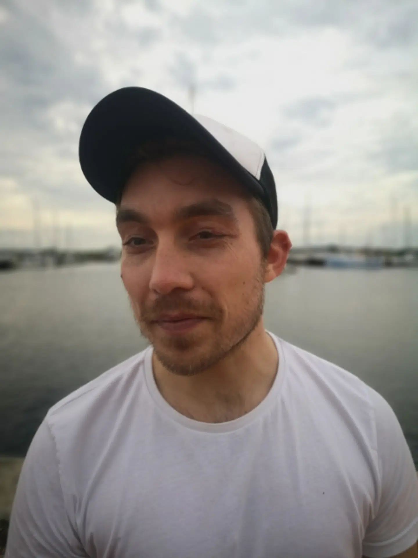 Her var Kasper Jensen alvorligt ramt af en allergisk reaktion. Privatfoto.