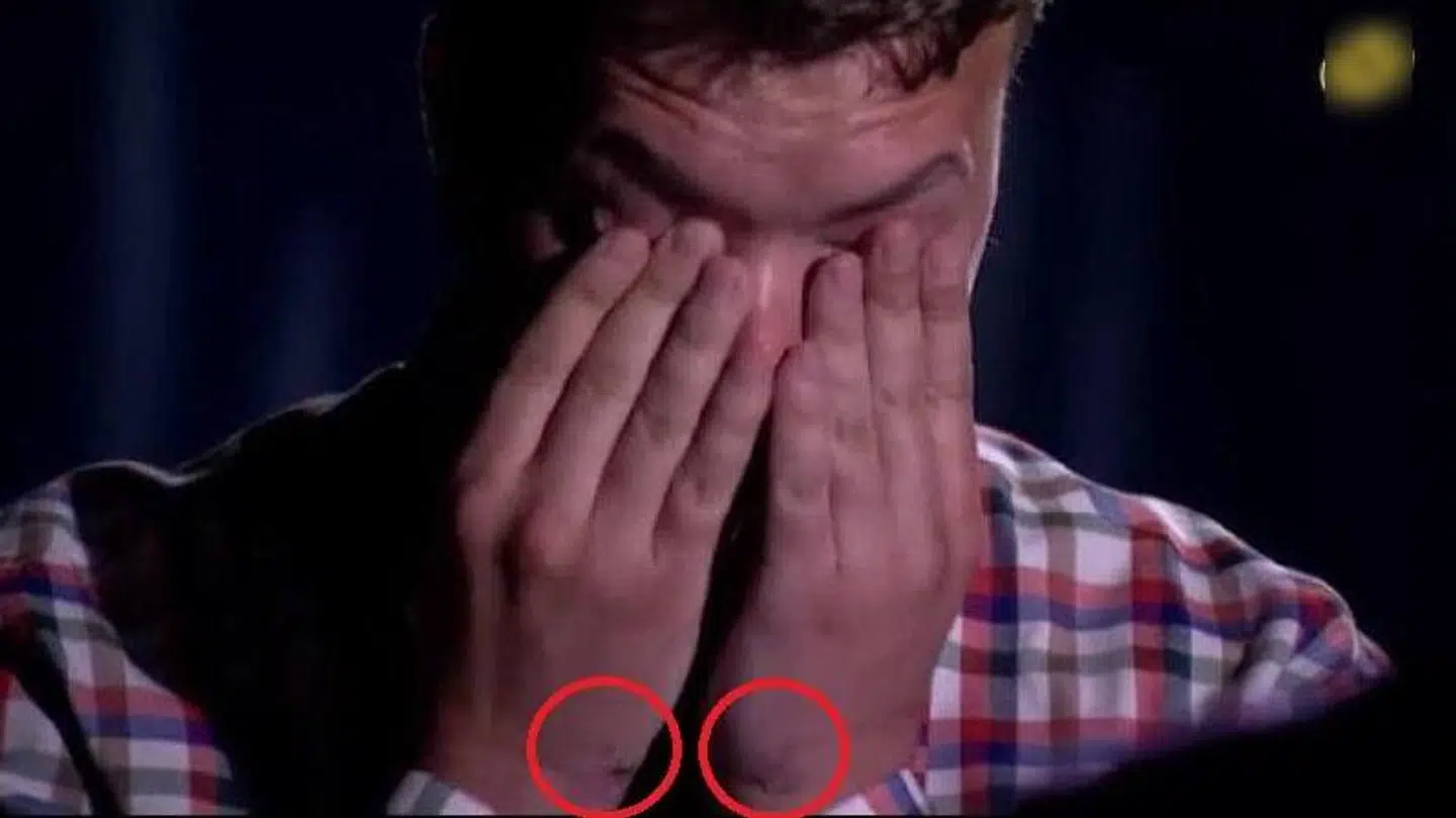 Den hviderussiske aktivist og journalist Roman Protasevichs håndled havde tydelige sår, da han torsdag aften optrådte i et tv-interview på hviderussisk stats-tv.