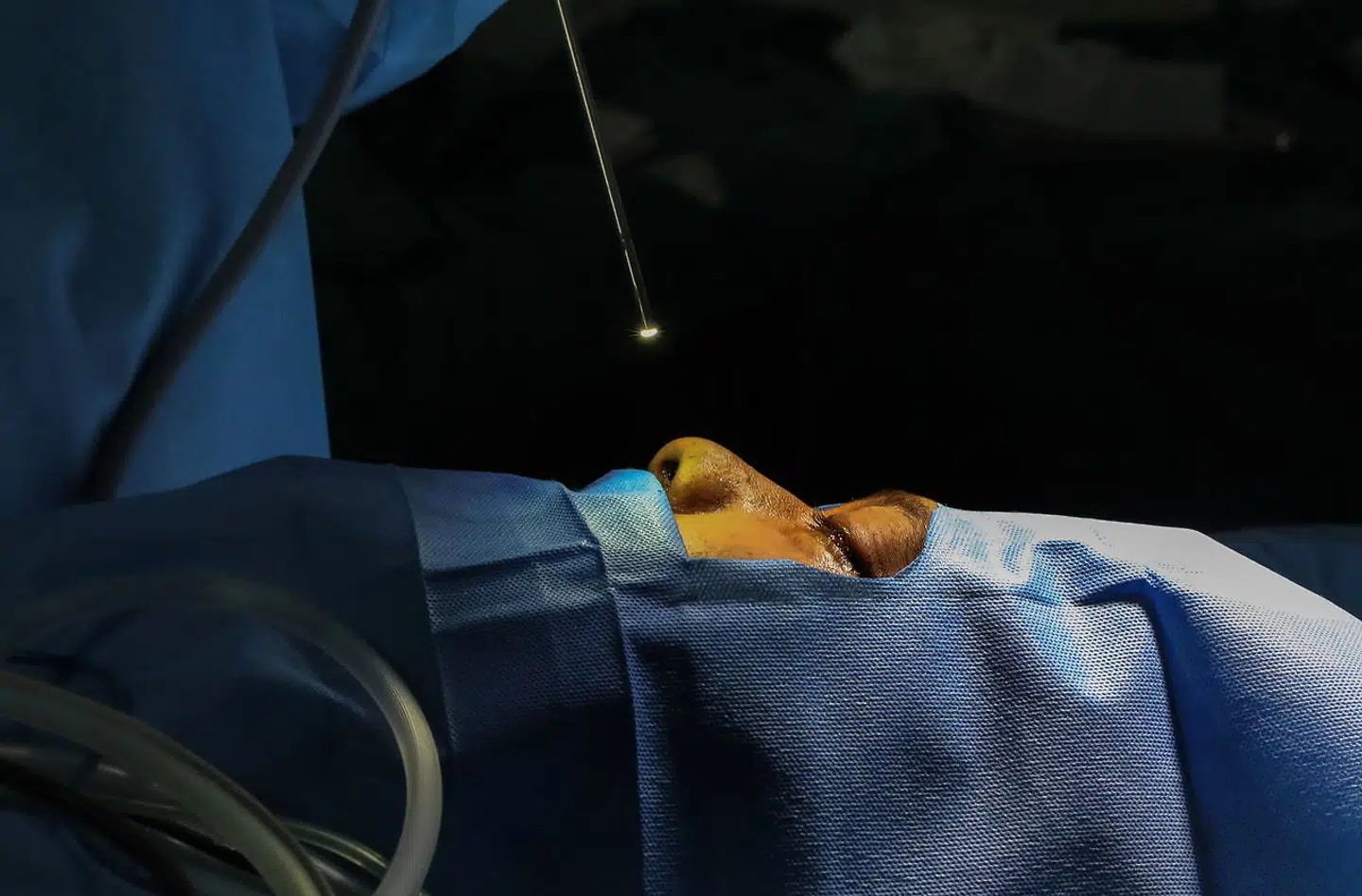 En patient, som er inficeret med 'den sorte svamp' under en operation.