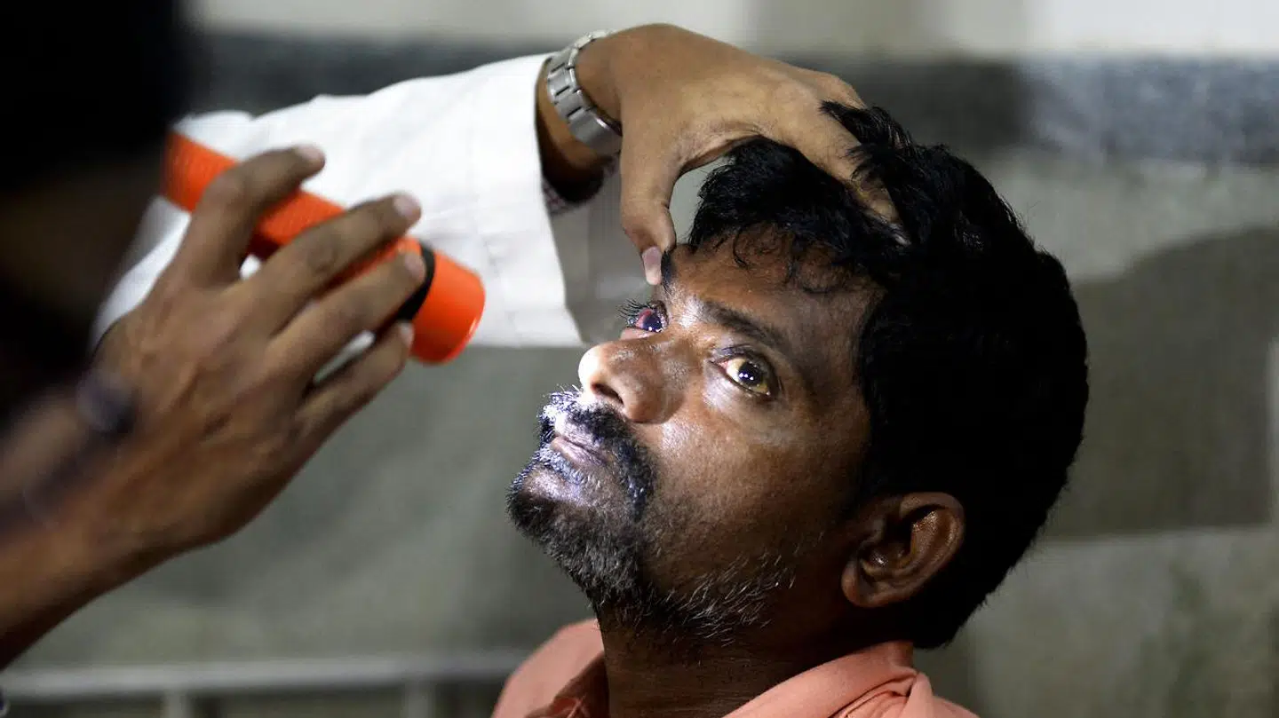 Arkivfoto. Langt de fleste patienter, som rammes af Mukormykose, er nødsaget til at få fjernet deres øje for at overleve sygdommen.