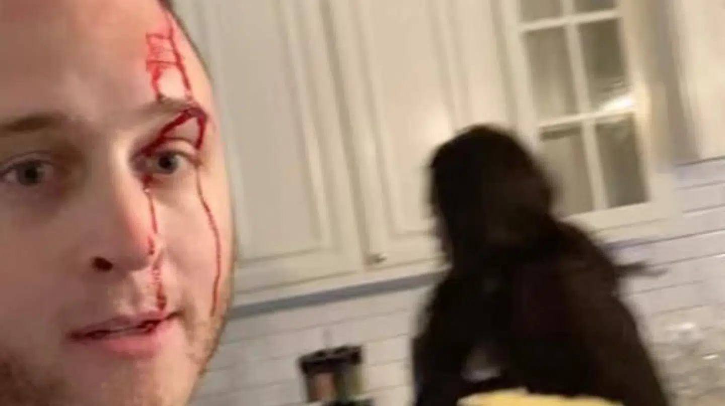 Chet Hanks under skænderiet med ekskæresten. (Foto: Screenshot)