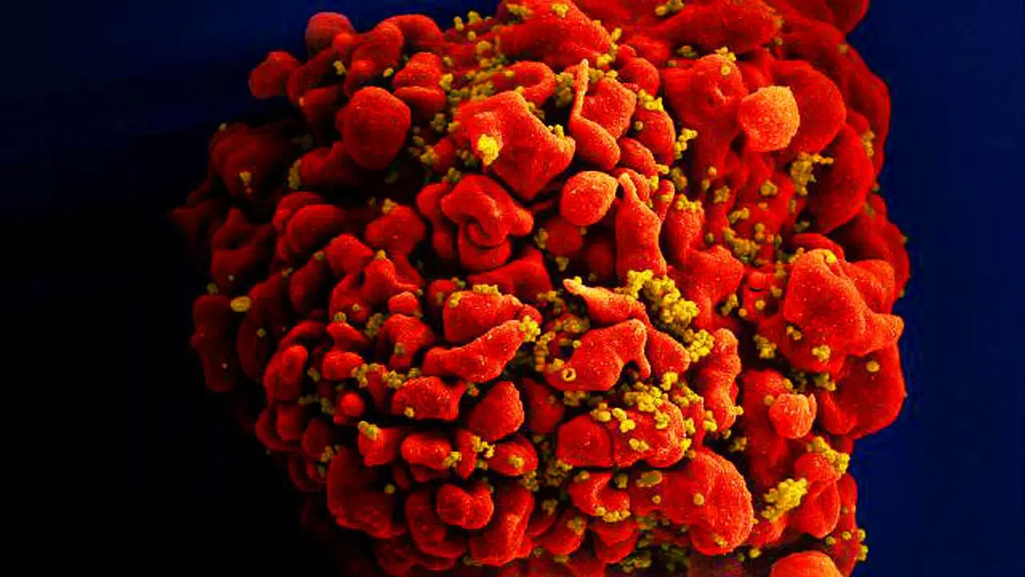 Forskerne fra MIT har i forsøg med mus set, hvordan vacciner der binder til slimhinder i lungerne booster lungernes T-celler, som er dem, der bekæmper virus og celler, der kan udvikle sig til cancer. På billedet ses en T-celle, der er inficeret med HIV-virus. Foto: Courtesy National Institute of Allergy and Infectious Diseases (NIAID)/Handout via REUTERS