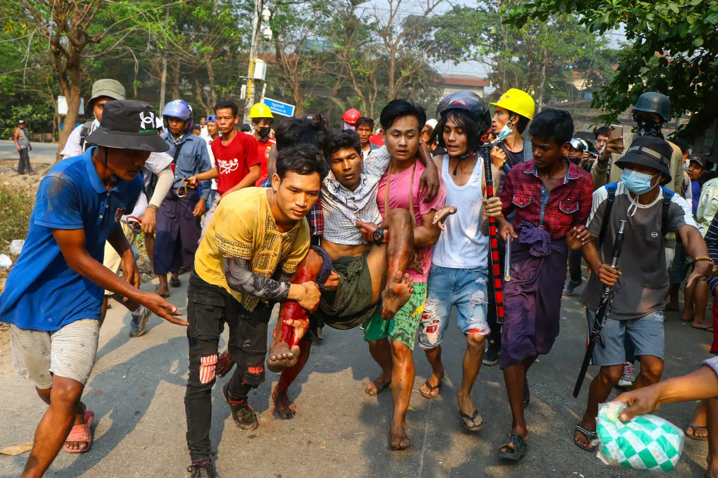 En beboer, som blev såret under sammenstød med sikkerhedsstyrkerne i distriktet Hlaingthaya i Yangon søndag, hjælpes i sikkerhed. Militæret har nu fået udvidede beføjelser til at sikre området, opretholde lov og orden og sikre ro mere effektivt, meddeler statsligt tv i Myanmar. Str./Ritzau Scanpix
