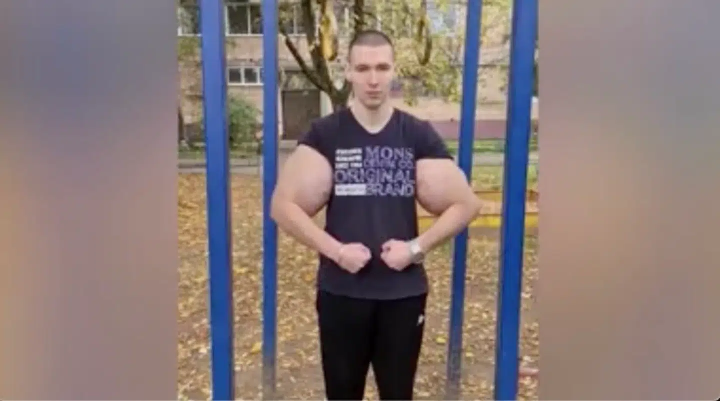 Kirill Tereshin med sine opsvulmede arme.