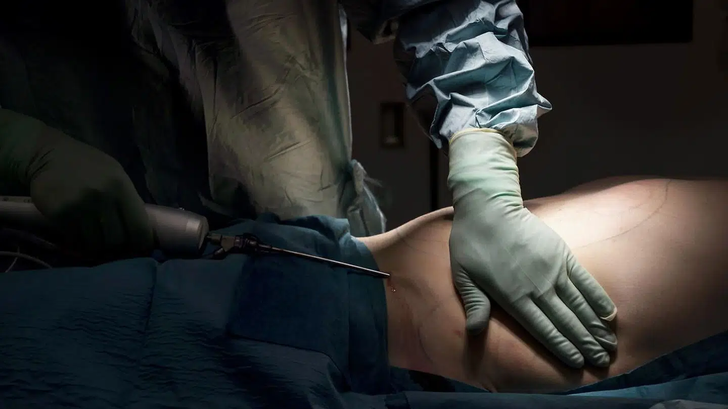 Flere klinikker i Danmark oplever en markant øget efterspørgsel på skønhedsoperationer. Foto: Scanpix