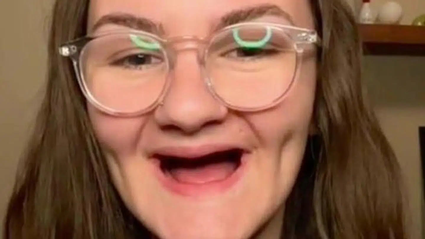 Det er et tandløst smil, som Faith Hille har efter sit misbrug.