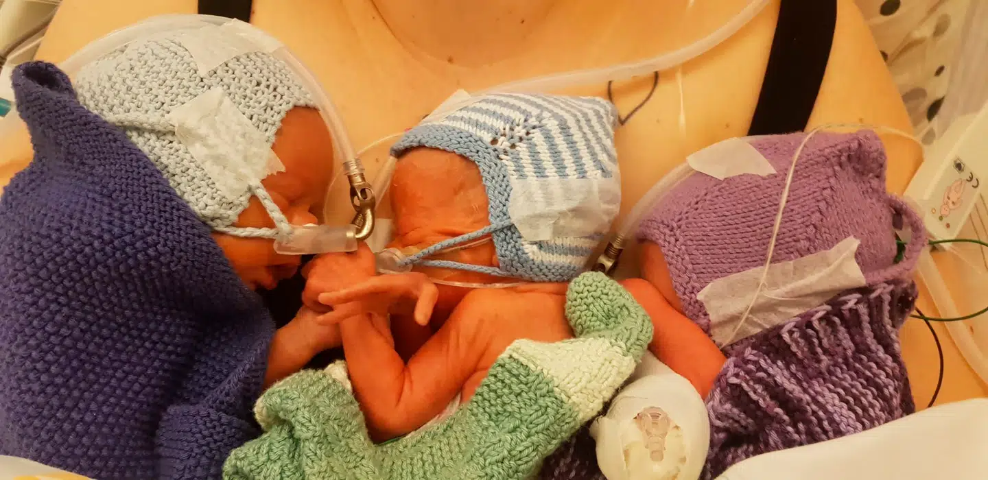 Tre små babyer, som kom til verden ved akut kejsersnit 08.01.20 (Privatfoto)