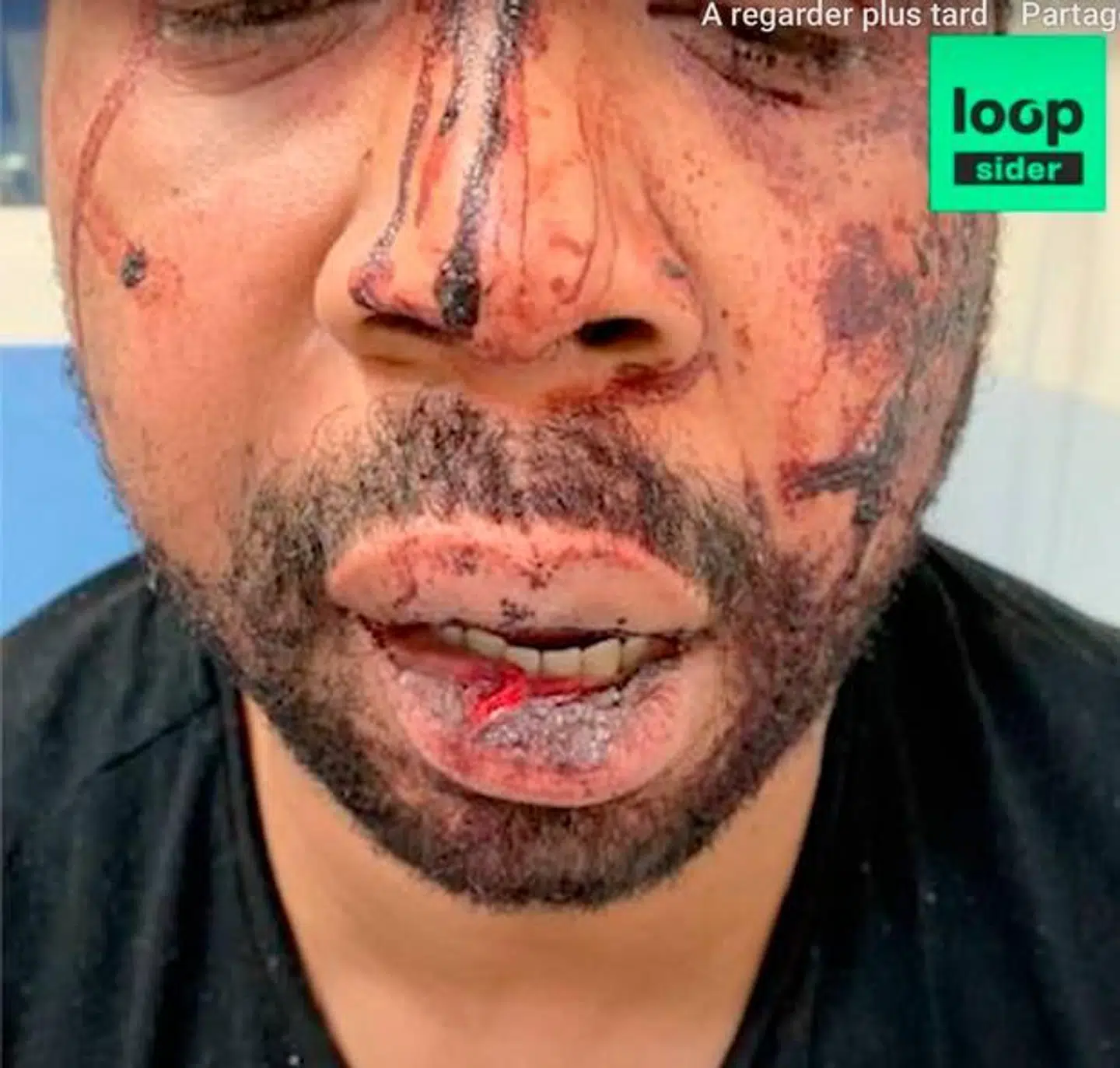 Et billede af musikeren efter mødet med det franske politi